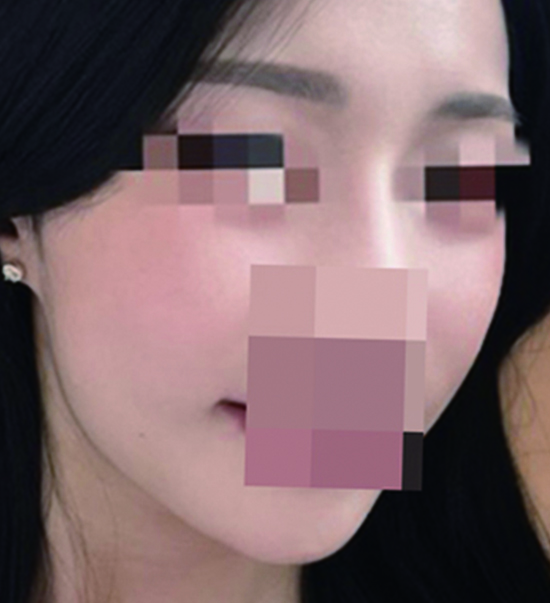 전후사진1